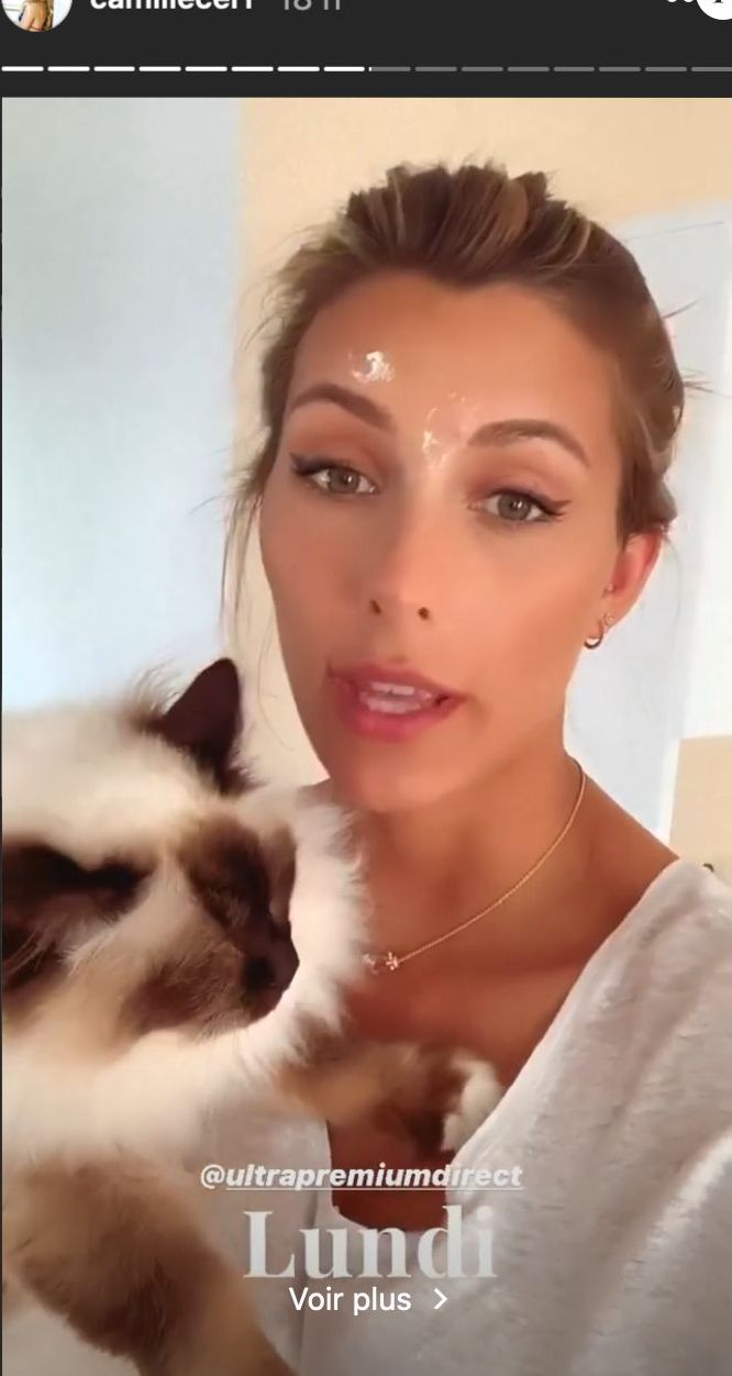 Camille Cerf : Sans filtre, elle dévoile ses boutons d’acné sur Instagram