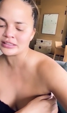 Chrissy Teigen se fait retirer ses implants mammaires et dévoile le résultat