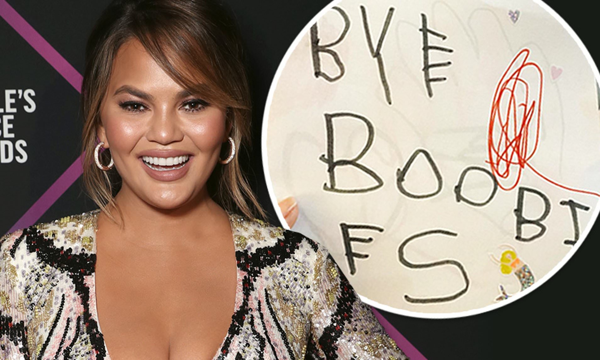 Chrissy Teigen se fait retirer ses implants mammaires et dévoile le résultat