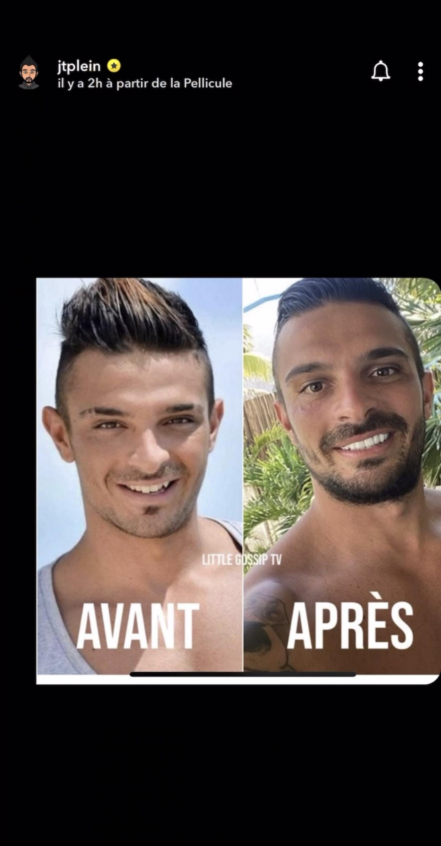 Julien Tanti (LMvsMonde5) : il répond à ceux qui l’accusent d’avoir fait de la chirurgie