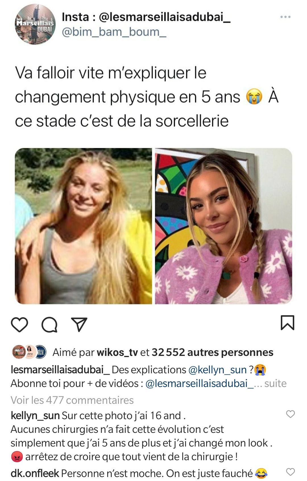 Kellyn Sun jugée méconnaissable sur d'anciennes photos, elle pousse un coup de gueule !