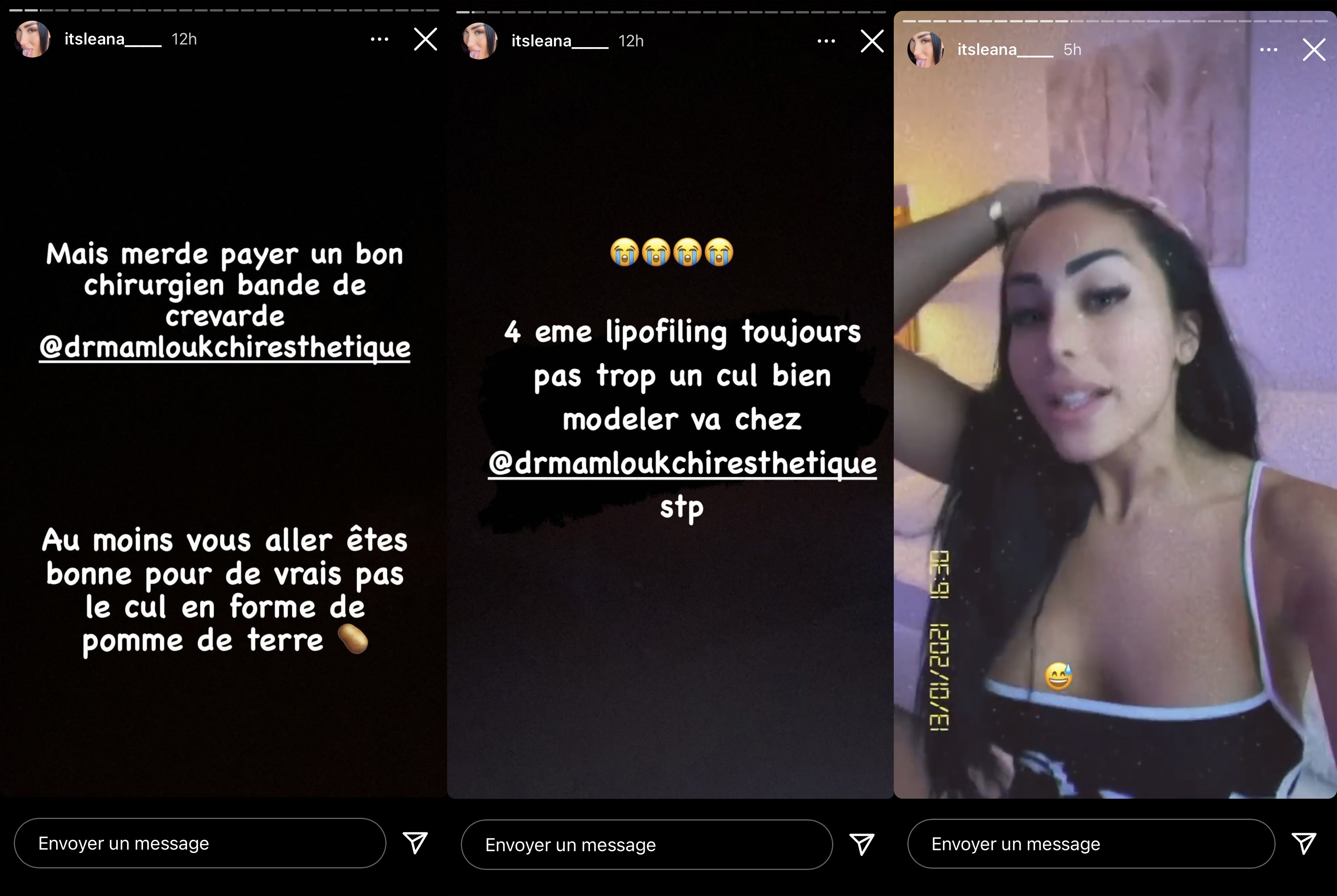  Jelena dévoile ses nouvelles fesses @ Instagram