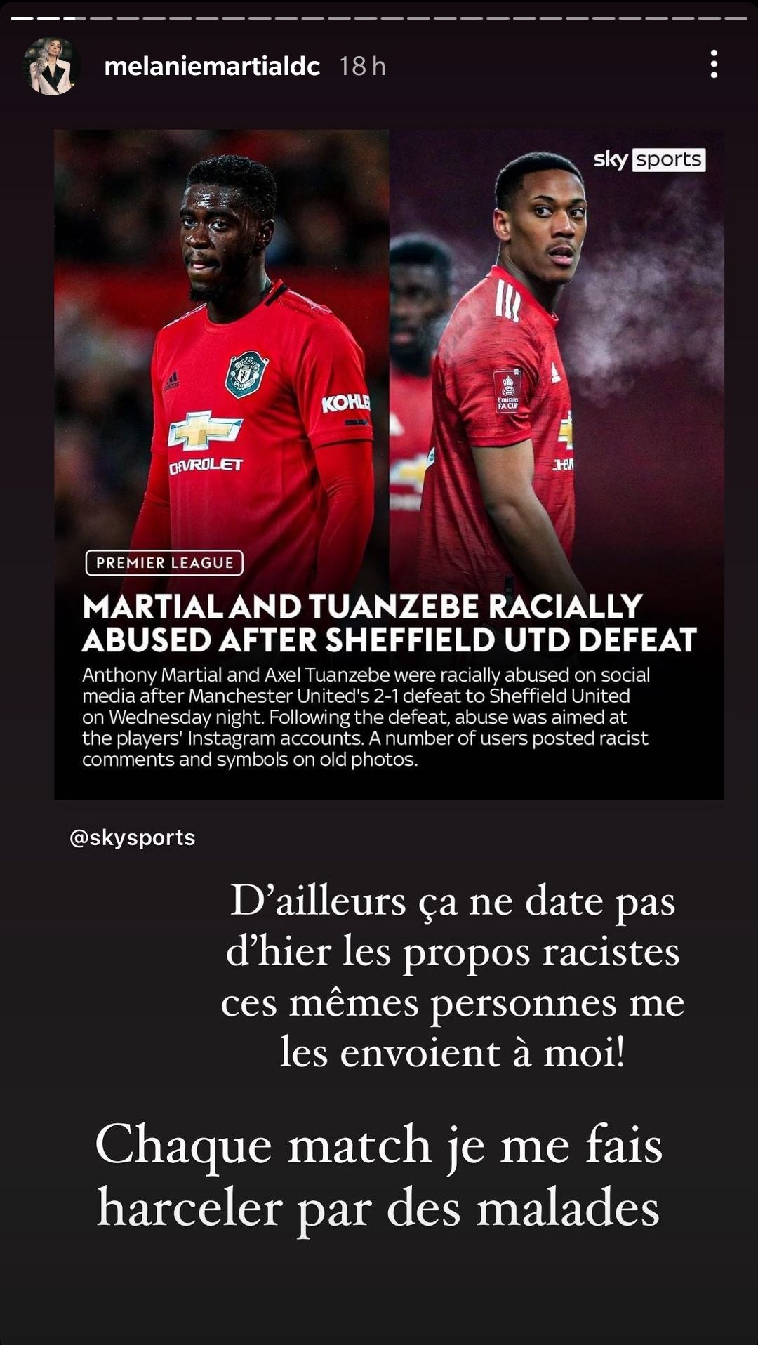 Mélanie Da Cruz  et Anthony Martial : Elle partage les messages racistes et menaces de mort reçus