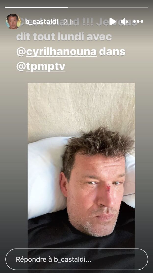 Benjamin Castaldi blessé au nez, il explique ce qu'il s'est passé