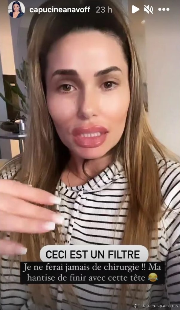 Capucine Anav transformée par la chirurgie esthétique ? Elle répond après une vidéo choc