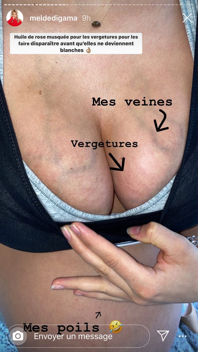  Mélanie Dedigama enceinte @Instagram