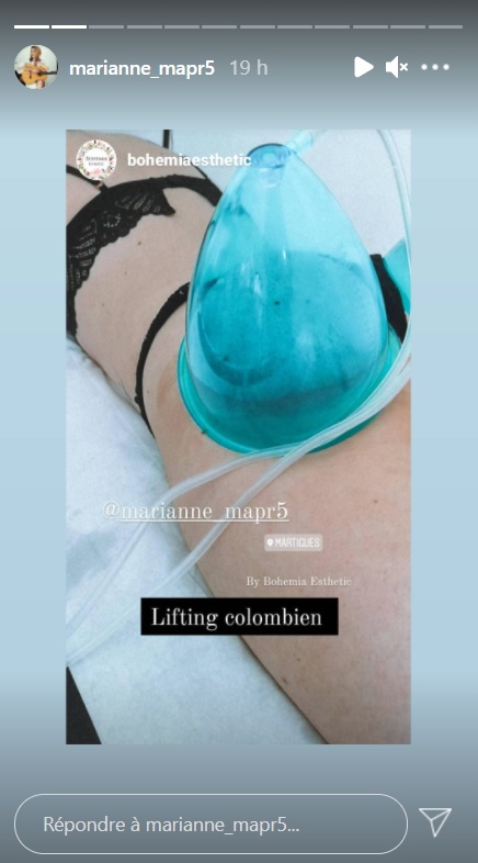  Mariane s'est offert un lifting colombien @Instagram