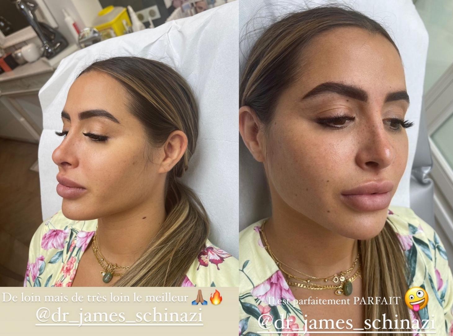  Marine El Himer dévoile son nouveau nez @Instagram