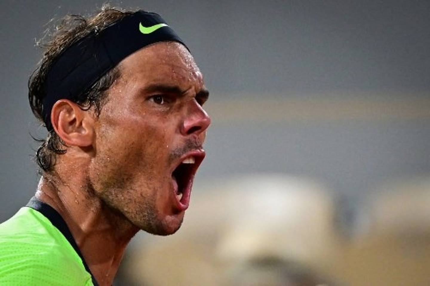 Rafael Nadal : Découvrez la somme folle qu'il a dépensée pour sa greffe de cheveux