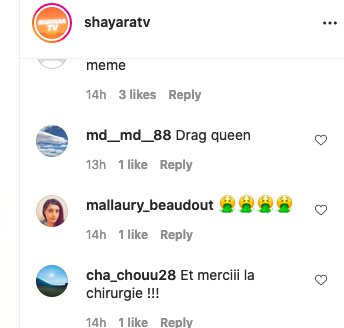  Océane El Himer avant et après la chirurgie esthétique @Instagram