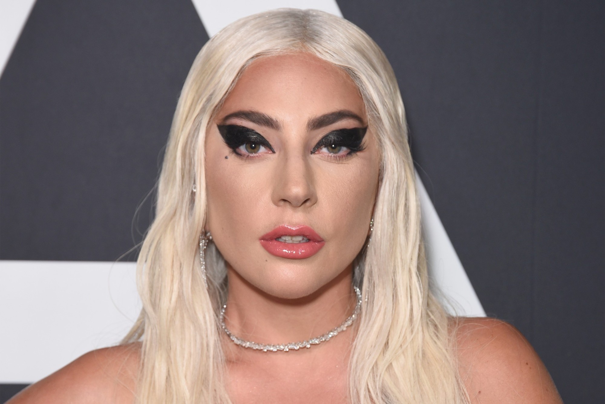 Lady Gaga : Son ancien dogsitter blessé par balle en février, désormais SDF