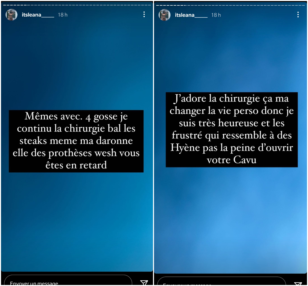  Léana Zaoui répond aux détracteurs qui critiquent ses opérations de chirurgie esthétique @Instagram