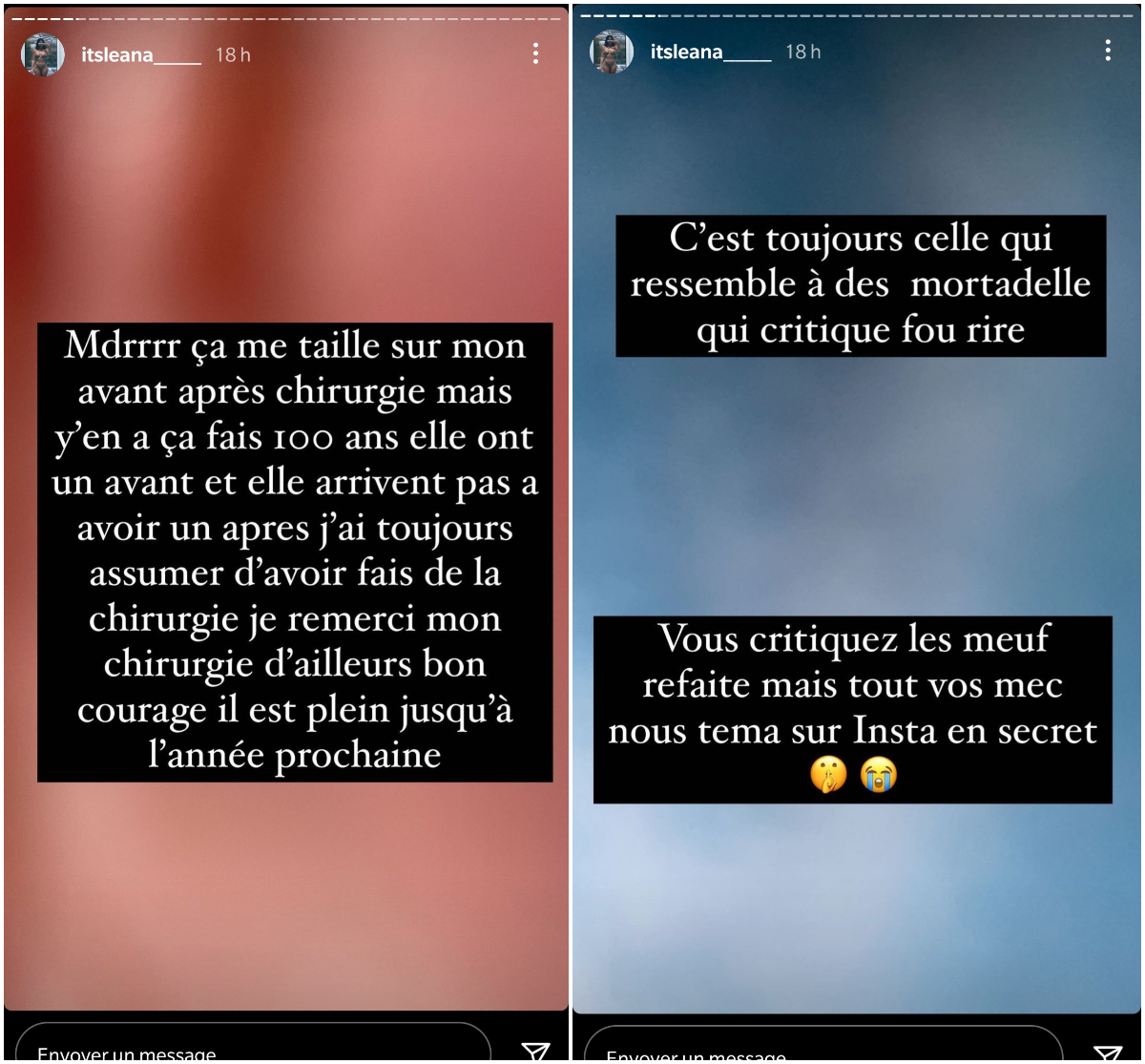  Léana Zaoui répond aux détracteurs qui critiquent ses opérations de chirurgie esthétique @Instagram