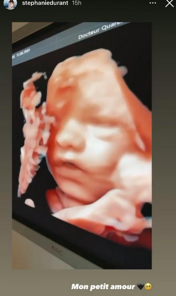  L'échographie 3D du bébé de Stéphanie Durant @Instagram