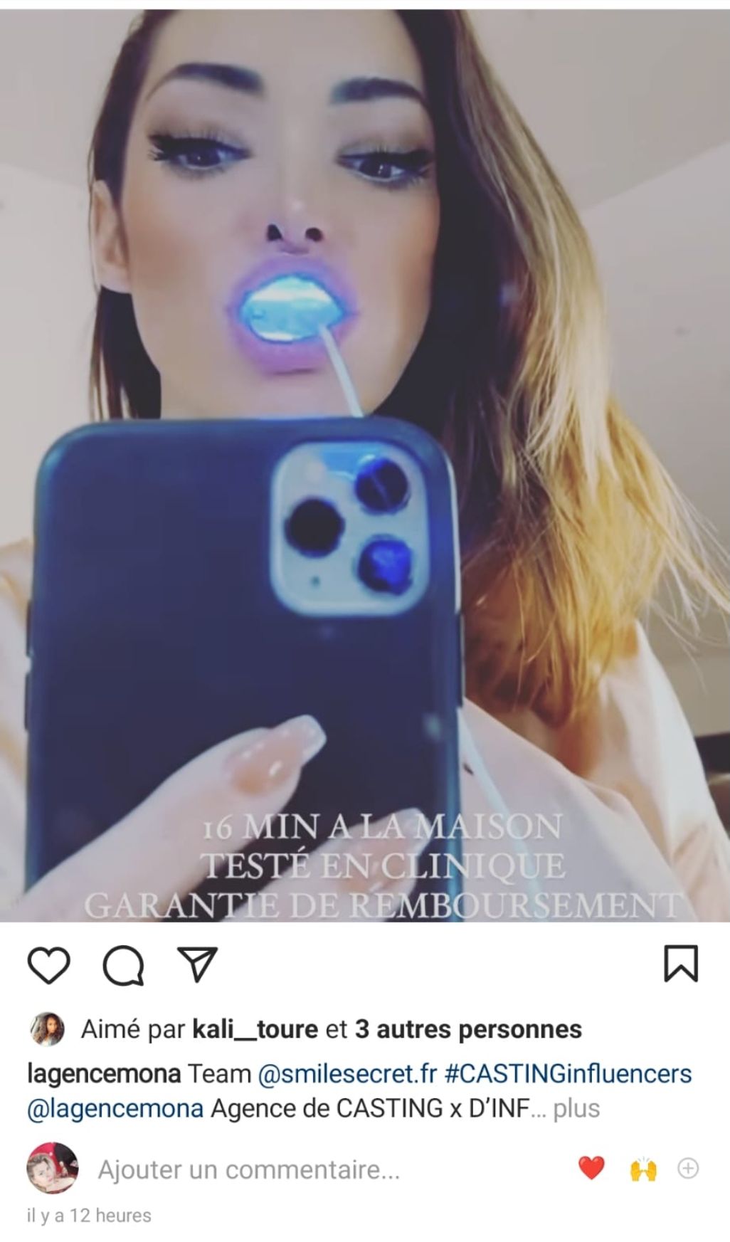  Emilie Nef Naf fait la promotion d'un blanchiment dentaire @Instagram