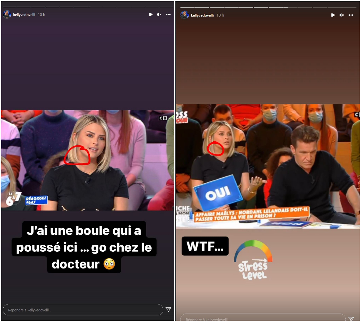 TPMP : Kelly Vedovelli angoissée après l’apparition d’une étrange boule dans son cou !