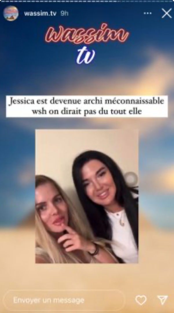  Jessica avant sa chirurgie @Instagram