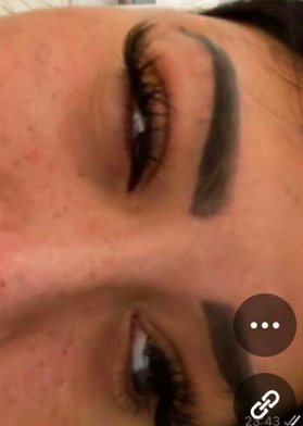  Maeva Ghennam souffre d'une allergie à l'oeil @Instagram