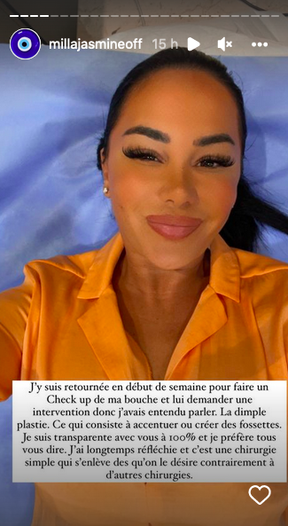  Milla Jasmine et sa nouvelle chirurgie esthétique @Instagram