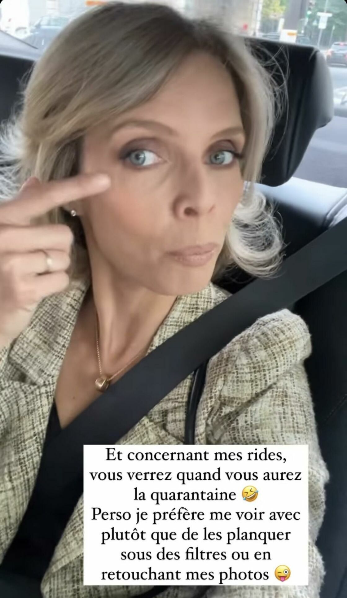 Sylvie Tellier assume ses rides : "Je préfère me voir avec plutôt que de les planquer"