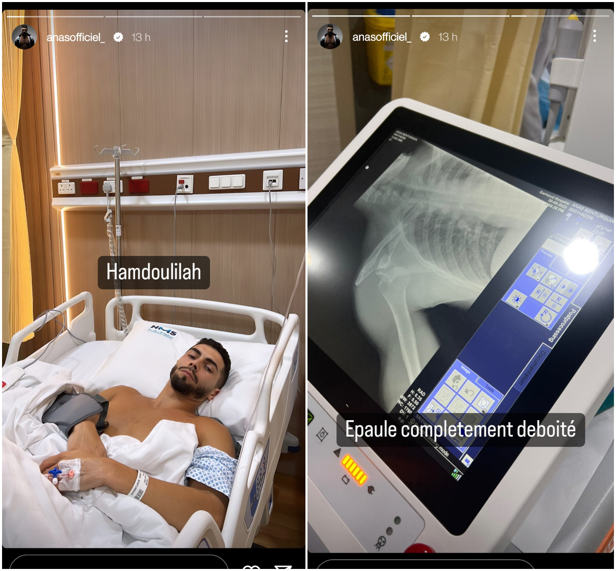  Anas dans son lit d'hôpital avec l'épaule déboitée @Instagram
