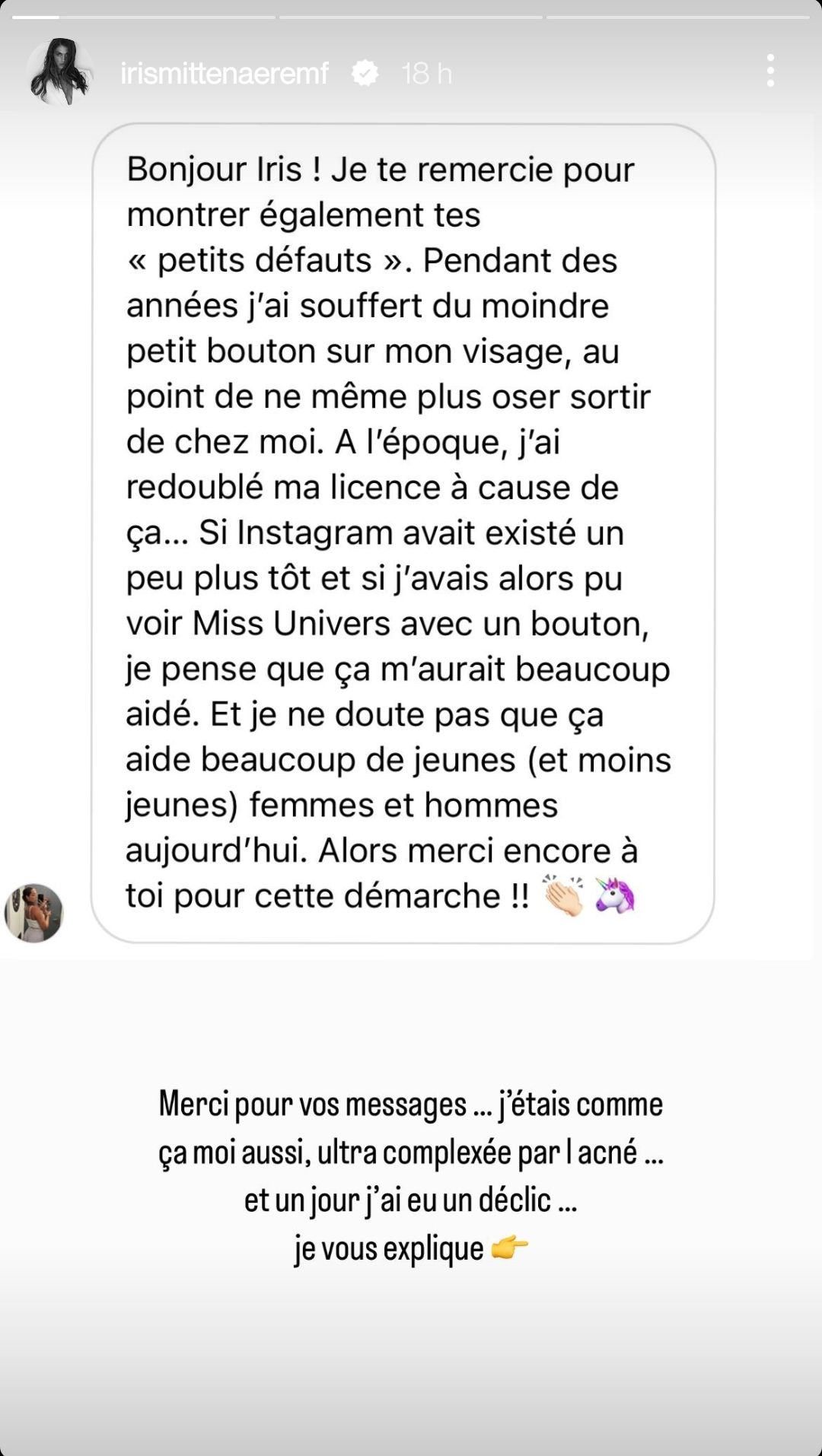 Iris Mittenaere touchée par l'acné : pourquoi elle ne se préoccupe plus du regard des autres