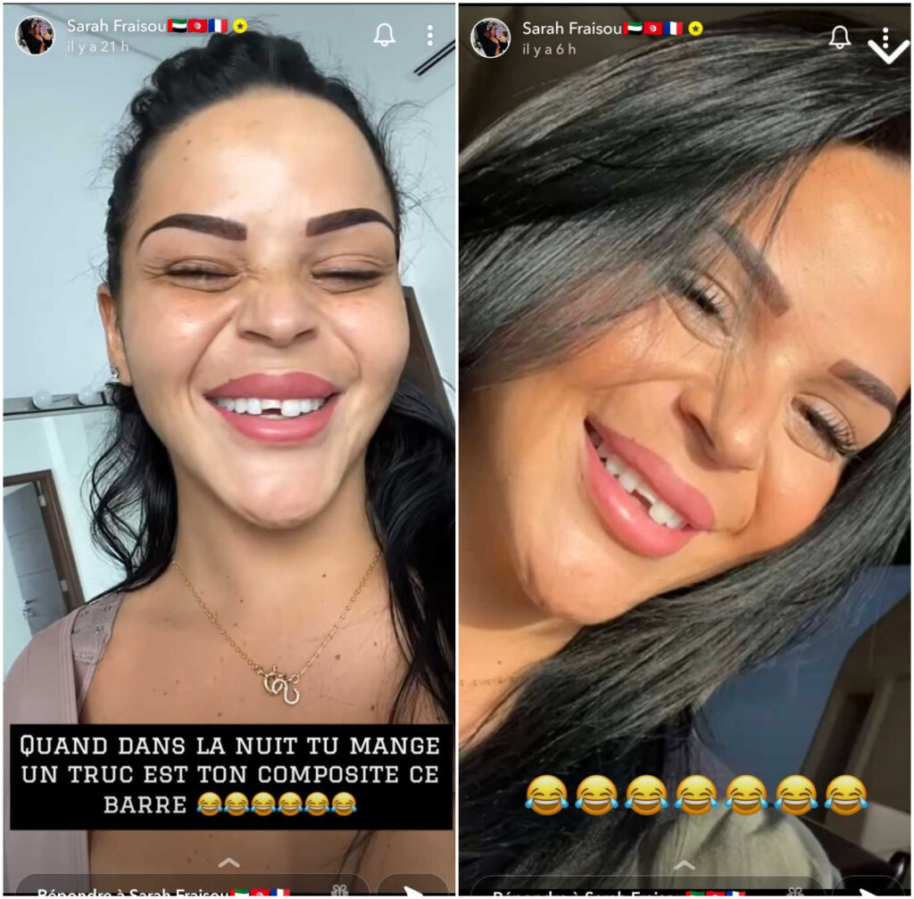 Sarah Fraisou se dévoile avec une moitié de dent en moins @Instagram