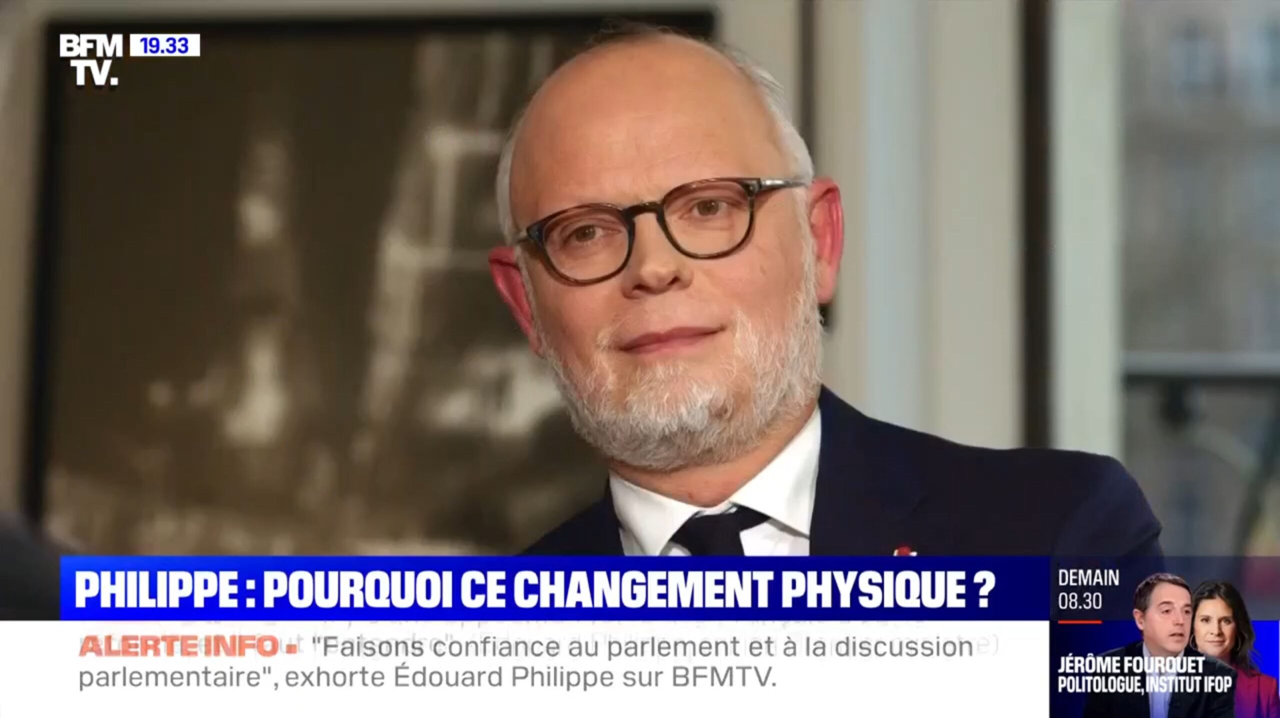 Édouard Philippe métamorphosé revient sur son alopécie : "J'ai perdu mes sourcils…"