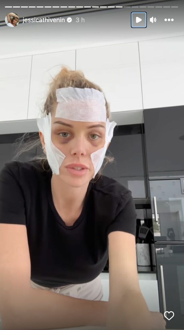 Jessica Thivenin : son visage après sa dernière opération de chirurgie esthétique "J’ai zéro regret"