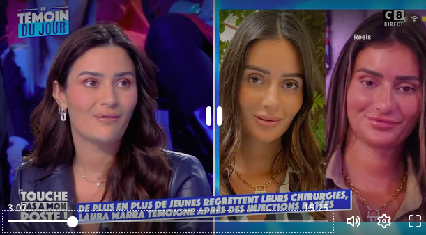 Laura Marra (Les Marseillais) : défigurée par des injections, elle retrouve son visage naturel