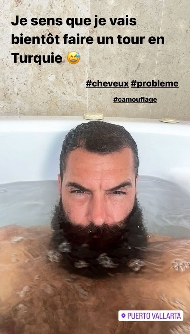 Benoît Paire : cette confidence surprenante sur ses problèmes de cheveux !