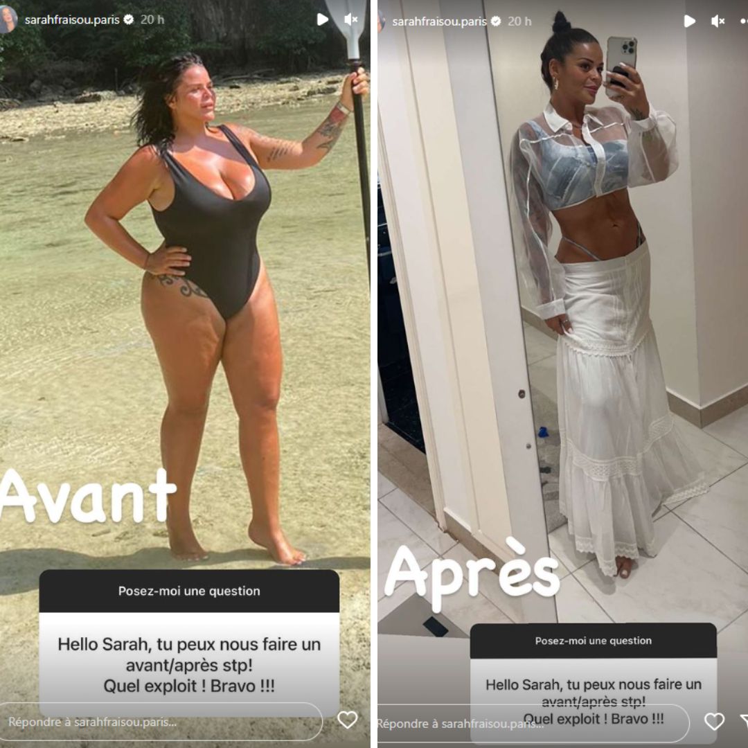 Sarah Fraisou amincie : elle dévoile son incroyable transformation après une nouvelle opération