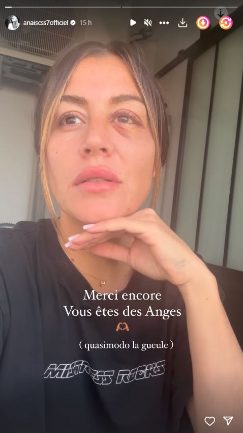 Anaïs Camizuli agressée : elle donne de ses nouvelles "C'est un petit passage de ma vie compliqué"