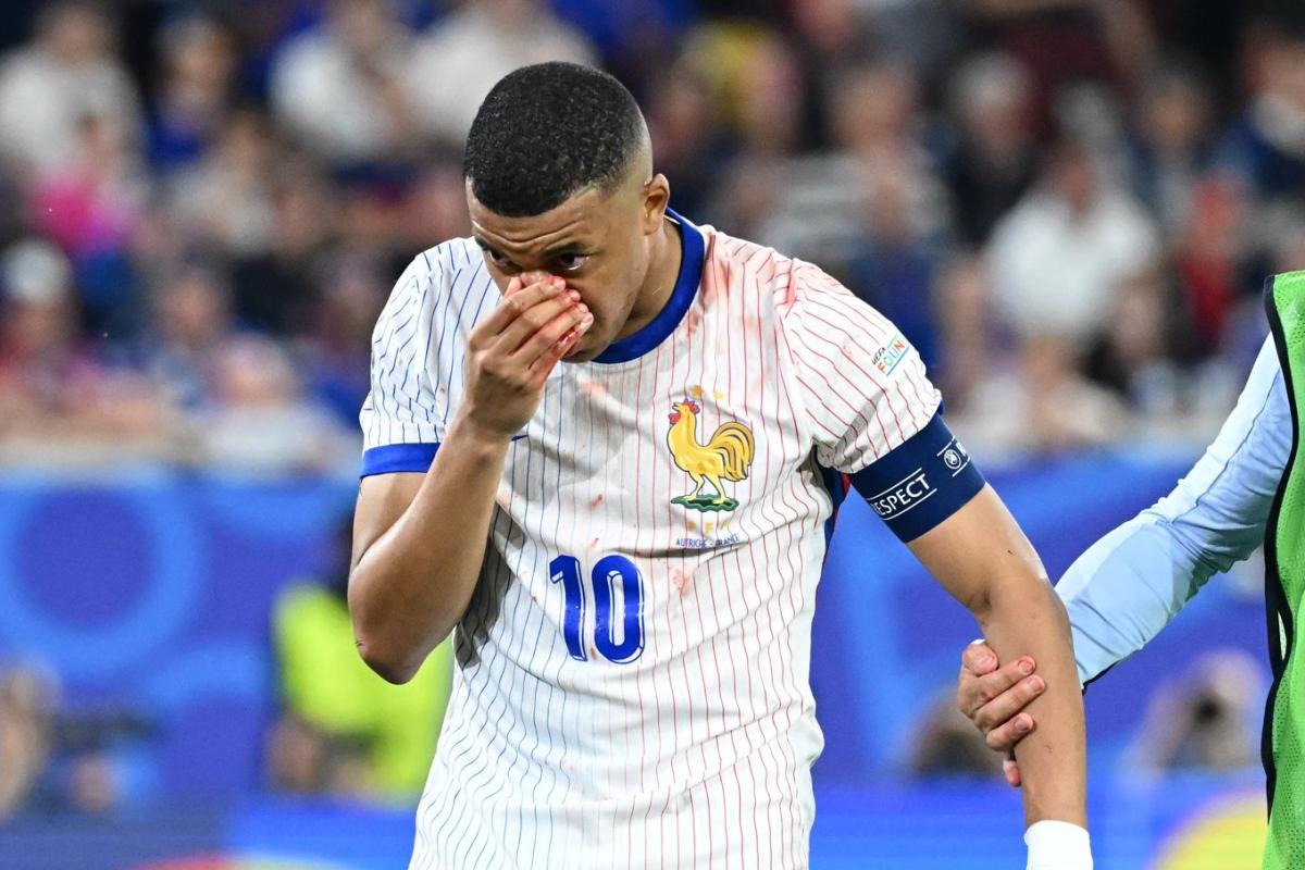 Kylian Mbappé, le nez en sang : le capitaine de l’équipe de France joue la carte de l’humour