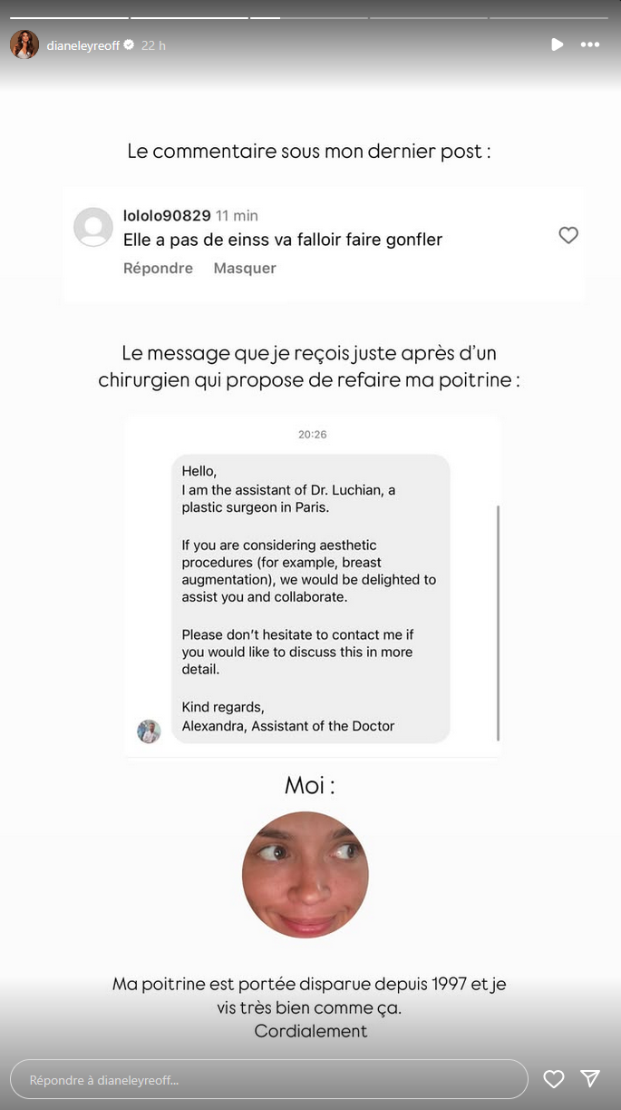 Diane Leyre critiquée sur son physique : elle reçoit une proposition d’un chirurgien esthétique !