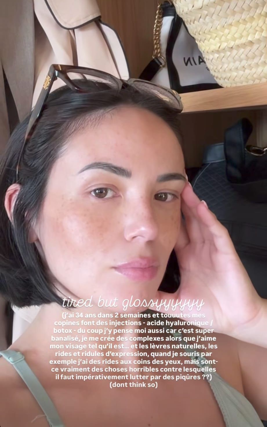 Agathe Auproux se confie sur ses doutes face à la médecine esthétique : "Je me crée des complexes"