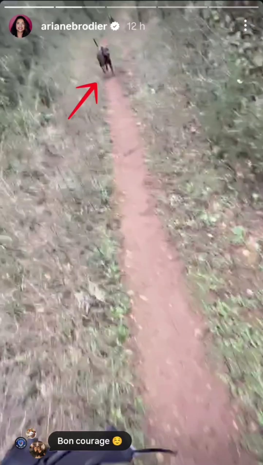 Ariane Brodier hospitalisée après avoir été violemment mordue par un chien : "Il y a un trou"