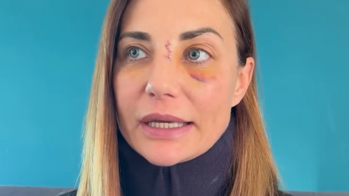 Ariane Brodier visage tuméfié prend la parole : &quot;Un homme que je ne connais pas m'a agressée&quot;