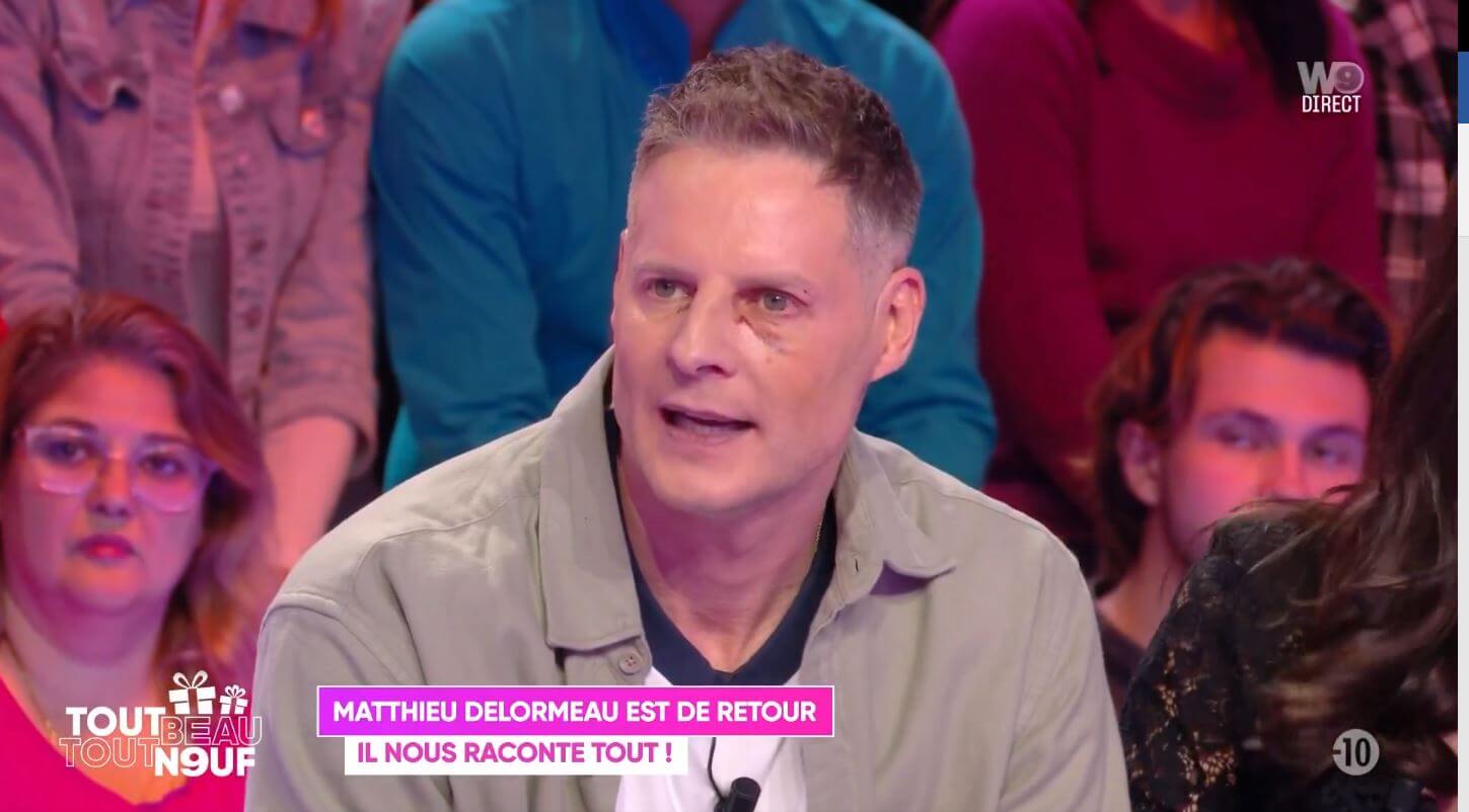 Tout beau tout n9uf : Matthieu Delormeau de retour le visage tuméfié, que lui est-il arrivé ?