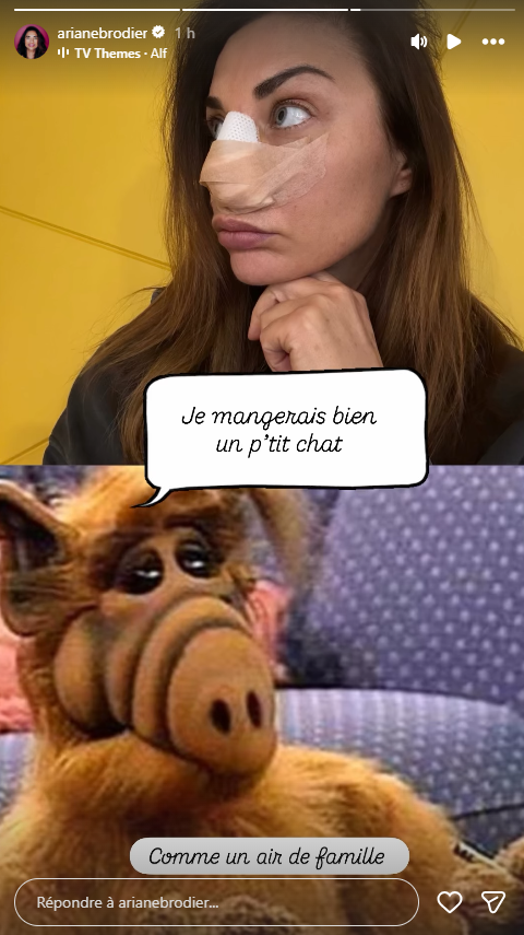 Ariane Brodier agressée : elle dévoile son visage après son opération