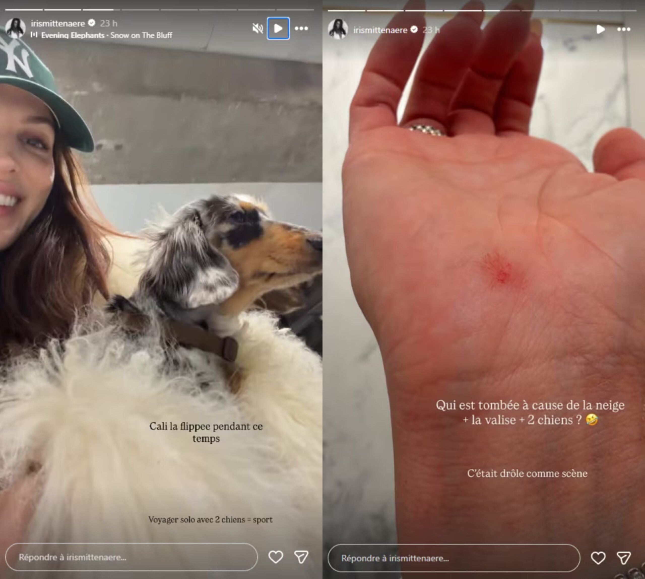 Iris Mittenaere blessée lors d’une chute avec ses deux chiennes, elle dévoile une photo sur les réseaux sociaux