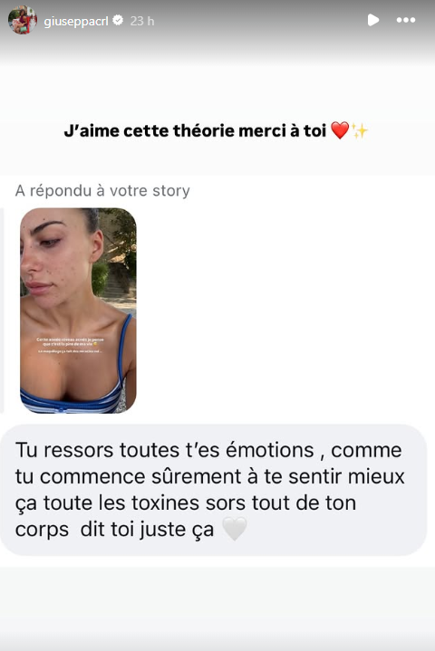 "La pire de ma vie" : Giuseppa Ciurleo s’affiche sans maquillage et dévoile son acné