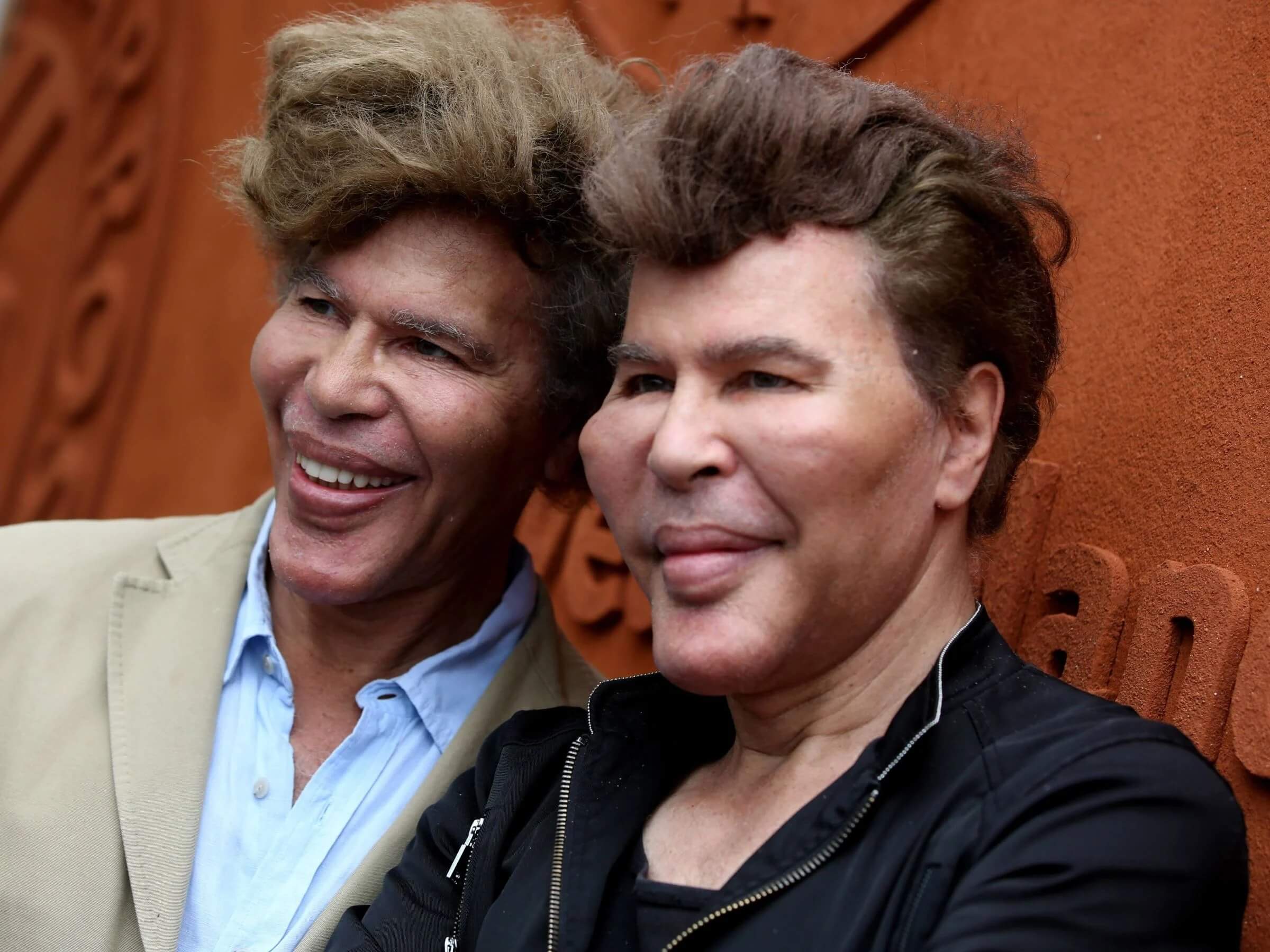Igor et Grichka Bogdanoff : leur sœur fait de rares révélations sur le mystère de leur visage